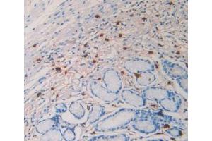 IHC-P analysis of Human Stomach Tissue, with DAB staining. (TPSAB1 antibody  (AA 161-262))