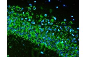 IF analysis of RPS6 using anti-RPS6 antibody (ABIN6719370) RPS6 was detected in paraffin-embedded section of rat brain tissues.