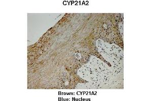 Sample Type : Monkey vagina  Primary Antibody Dilution :  1:25  Secondary Antibody: Anti-rabbit-HRP  Secondary Antibody Dilution:  1:1000  Color/Signal Descriptions: Brown: CYP21A2 Blue: Nucleus  Gene Name: CYP21A2  Submitted by: Jonathan Bertin, Endoceutics Inc. (CYP21A2 antibody  (C-Term))