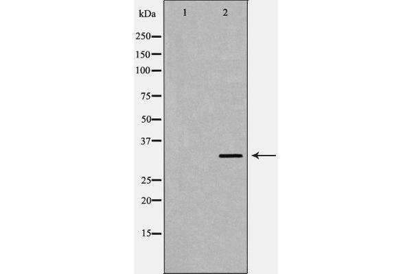 GIPC2 antibody  (C-Term)