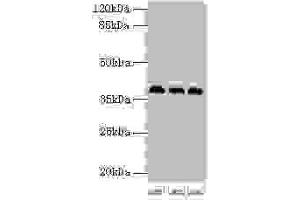 Western blot All lanes: HNRNPD antibody at 2 μg/mL Lane 1: 293T whole cell lysate Lane 2: Hela whole cell lysate Lane 3: Jurkat whole cell lysate Secondary Goat polyclonal to rabbit IgG at 1/10000 dilution Predicted band size: 39, 37, 33, 31 kDa Observed band size: 39 kDa (HNRNPD/AUF1 antibody  (AA 18-355))