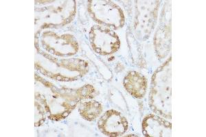 Immunohistochemistry of paraffin-embedded rat kidney using NEURL1B Rabbit pAb (ABIN7268857) at dilution of 1:100 (40x lens). (NEURL1B antibody)