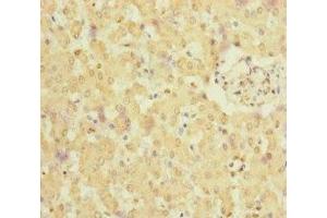 Immunohistochemistry of paraffin-embedded human liver tissue using ABIN7165719 at dilution of 1:100 (NELL1 antibody  (AA 160-420))