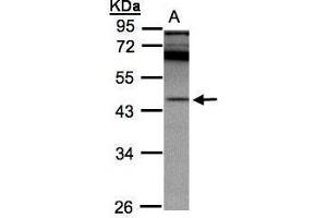 WB Image Sample(30 ug whole cell lysate) A:A431, 10% SDS PAGE antibody diluted at 1:2000 (SCPEP1 antibody)