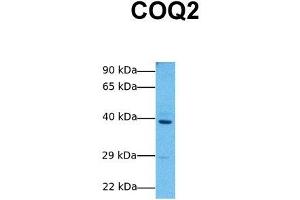 Host:  Rabbit  Target Name:  COQ2  Sample Tissue:  Human MCF7  Antibody Dilution:  1.