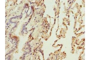 Immunohistochemistry of paraffin-embedded human lung tissue using ABIN7159816 at dilution of 1:100 (OGN antibody  (AA 20-298))