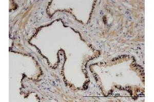 Immunoperoxidase of monoclonal antibody to ZHX3 on formalin-fixed paraffin-embedded human prostate. (ZHX3 antibody  (AA 863-955))