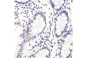 Immunohistochemistry of paraffin-embedded human colon using H4K20me2 antibody. (Histone H4 antibody  (2meLys20))