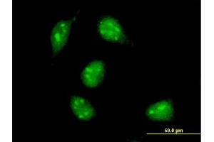 Immunofluorescence of monoclonal antibody to MAX on HeLa cell. (MAX antibody  (AA 1-151))