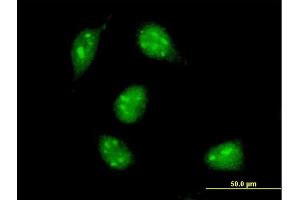 Immunofluorescence of monoclonal antibody to MAX on HeLa cell.