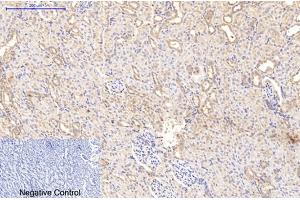 Immunohistochemical analysis of paraffin-embedded rat kidney tissue. (Collagen Type I antibody)