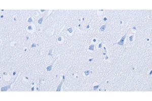 Immunohistochemistry (Paraffin-embedded Sections) (IHC (p)) image for anti-Potassium Large Conductance Calcium-Activated Channel, Subfamily M beta Member 3 (KCNMB3) antibody (ABIN7243499)