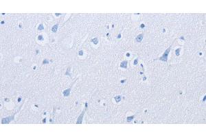 Immunohistochemistry of paraffin-embedded using KCNMB3 Polyclonal Antibody at dilution of 1: