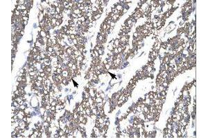 Image no. 1 for anti-SMAD, Mothers Against DPP Homolog 6 (SMAD6) (AA 137-182) antibody (ABIN202662) (SMAD6 antibody  (AA 137-182))