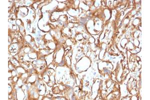 Formalin-fixed, paraffin-embedded human Placenta stained with Ezrin Mouse Monoclonal Antibody (CPTC-Ezrin-1).