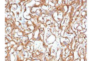 Formalin-fixed, paraffin-embedded human Placenta stained with Ezrin Mouse Monoclonal Antibody (CPTC-Ezrin-1). (Ezrin antibody)
