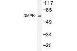 Western blot analysis of DMPK antibody in extracts from Jurkat cell.