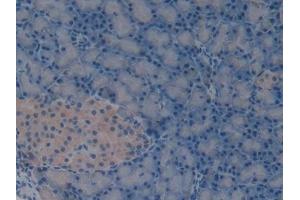 Detection of LAMA1 in Rat Pancreas Tissue using Polyclonal Antibody to Laminin Alpha 1 (LAMA1)