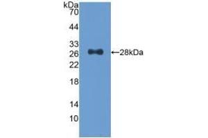 Detection of Recombinant CDK9, Human using Polyclonal Antibody to Cyclin Dependent Kinase 9 (CDK9) (CDK9 antibody  (AA 104-315))