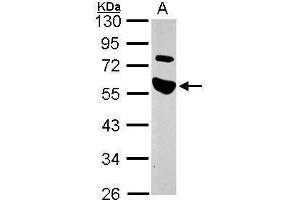 WB Image Sample (30 ug of whole cell lysate) A: A549 10% SDS PAGE antibody diluted at 1:1000 (TRAIP antibody)