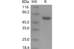 Western Blotting (WB) image for Carnosine Dipeptidase 1 (Metallopeptidase M20 Family) (CNDP1) (Active) protein (His tag) (ABIN7320096) (CNDP1 Protein (His tag))