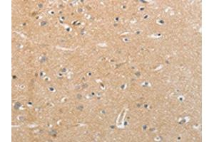 The image on the left is immunohistochemistry of paraffin-embedded Human brain tissue using ABIN7191635(NFASC Antibody) at dilution 1/30, on the right is treated with synthetic peptide. (NFASC antibody)