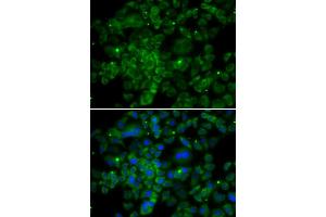 Immunofluorescence analysis of MCF-7 cells using CCL2 antibody (ABIN4903158). (CCL2 antibody)