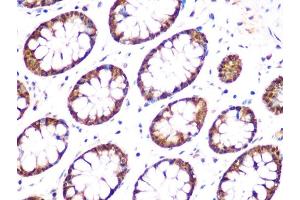 Immunohistochemistry of paraffin-embedded human colon using UCHL3 Rabbit mAb (ABIN1682628, ABIN3015461, ABIN3015462 and ABIN7101429) at dilution of 1:100 (40x lens). (UCHL3 antibody)