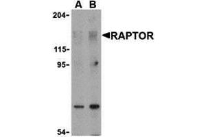 Western Blotting (WB) image for anti-RAPTOR (RAPTOR) (N-Term) antibody (ABIN1031532) (RAPTOR antibody  (N-Term))