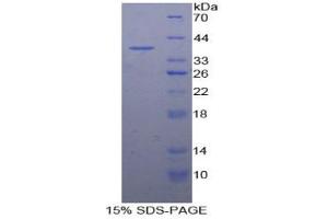 SDS-PAGE analysis of Human Metallothionein 3 Protein.
