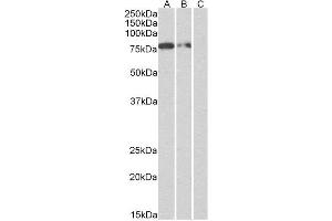 (1 µg/ml, right panel) staining of Multitag protein at 25 ng (A), 10 ng (B) and 5 ng (C) amounts. (Recombinant His Tag antibody)