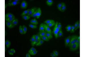 Immunofluorescence staining of HepG2 cells with ABIN7175437 at 1:100, counter-stained with DAPI. (VLDLR antibody  (AA 133-247))