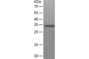 Western Blotting (WB) image for Crystallin, zeta (CRYZ) (AA 1-329) protein (His tag) (ABIN7287009) (CRYZ Protein (AA 1-329) (His tag))