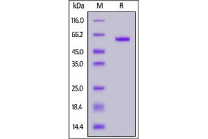 SARS-CoV-2 S protein RBD (K417T, E484K, N501Y), Fc Tag on  under reducing (R) condition.