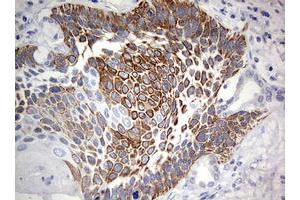 Immunohistochemistry (IHC) image for anti-Chromosome 3 Open Reading Frame 15 (C3orf15) (AA 1-313) antibody (ABIN2715591) (C3orf15 antibody  (AA 1-313))