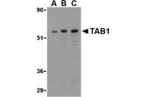 Western blot analysis of TAB1 in 3T3 cell lysate with this product at (A) 0. (TAB1 antibody  (Center))