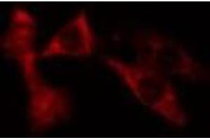ABIN6275683 staining NIH-3T3 cells by IF/ICC. (WASF3 antibody  (Internal Region))