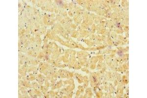Immunohistochemistry of paraffin-embedded human heart tissue using ABIN7161254 at dilution of 1:100 (NBAS antibody  (AA 1-70))