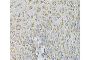 Immunohistochemistry of paraffin-embedded Human esophagus using AP2B1 Polyclonal Antibody at dilution of 1:100 (40x lens).