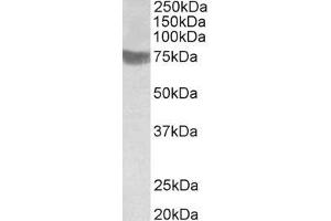 ABIN343748 (1µg/ml) staining of Human Skeletal Muscle lysate (35µg protein in RIPA buffer). (RNF139 antibody  (C-Term))