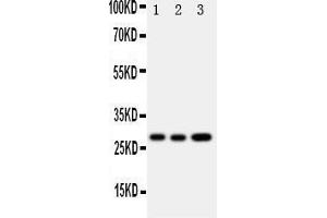 Western Blotting (WB) image for anti-Oncostatin M (OSM) (AA 181-198), (Middle Region) antibody (ABIN3043117)