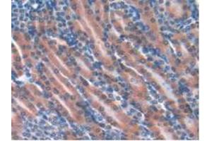 Detection of GPX4 in Mouse Kidney Tissue using Polyclonal Antibody to Glutathione Peroxidase 4 (GPX4) (GPX4 antibody  (AA 74-197))