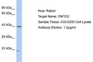 Host: Rabbit Target Name: ZNF232 Sample Type: COLO205 Whole cell lysates Antibody Dilution: 1. (ZNF232 antibody  (N-Term))