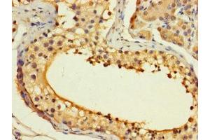 Immunohistochemistry of paraffin-embedded human testis tissue using ABIN7155297 at dilution of 1:100 (ASF1B antibody  (AA 1-202))
