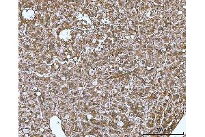 IHC analysis of MIF using anti-MIF antibody (ABIN3043878).