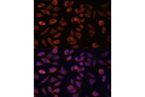 Immunofluorescence analysis of L929 cells using TRIM47 antibody (ABIN7270991) at dilution of 1:100. (TRIM47 antibody  (AA 356-530))