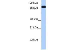 Transfected 293T; WB Suggested Anti-PRICKLE3 Antibody Titration: 0. (PRICKLE3 antibody  (C-Term))