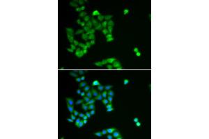Immunofluorescence analysis of U2OS cells using PJA2 antibody (ABIN5973844). (PJA2 antibody)