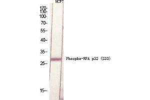 Western Blot (WB) analysis of specific cells using Phospho-RPA p32 (S33) Polyclonal Antibody. (RPA2 antibody  (pSer33))