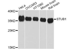 Western blot analysis of extracts of various cell lines, using STUB1 Antibody. (STUB1 antibody  (AA 1-303))